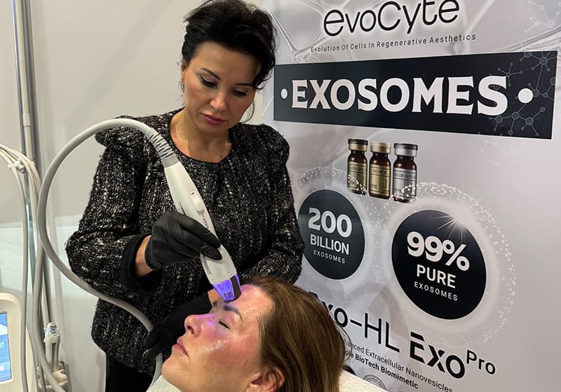 Vivace RF Microneedling with Exosomes