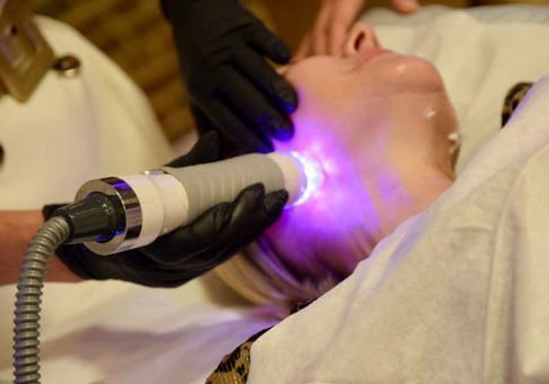 Vivace RF Microneedling with LED